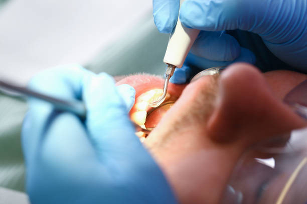 Best Walk-In Emergency Dentist in Camden, NJ