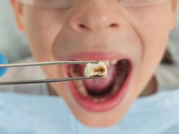 Best Emergency Treatment for Toothache in Camden, NJ
